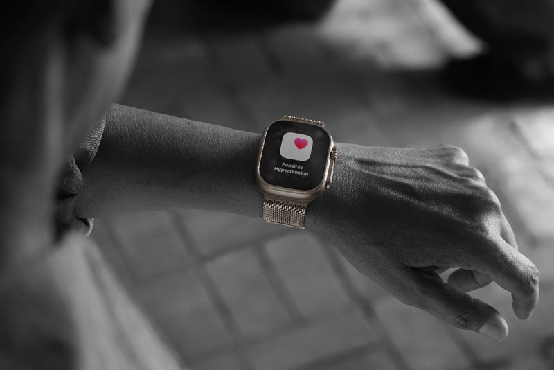 Apple Watch Ultra 3