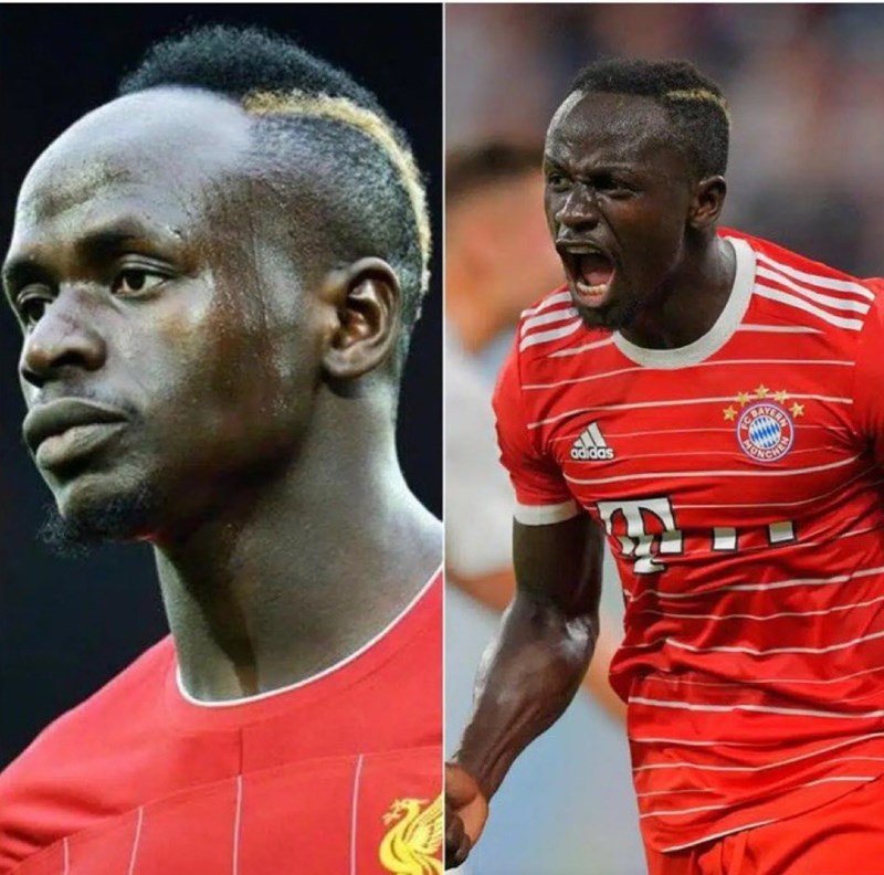 Η μεταμόσχευση μαλλιών του Σαντιό Μανέ