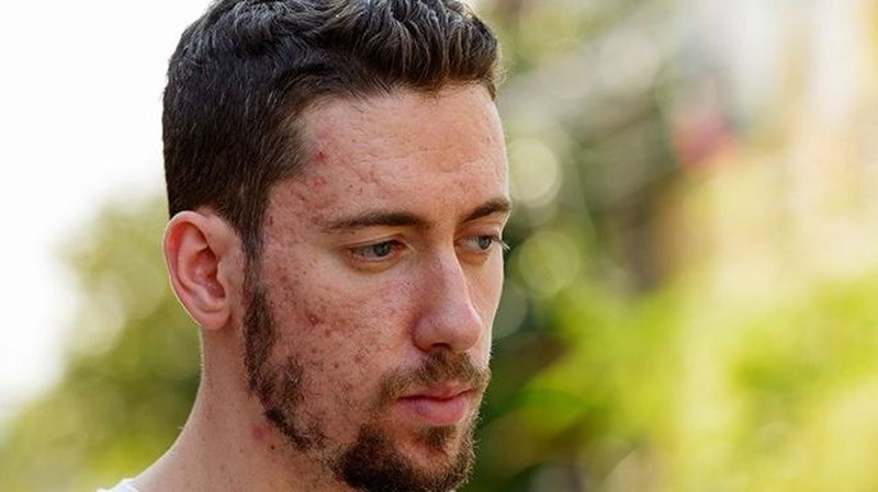 ΟΥΛΕΣ ΠΡΟΣΩΠΟ