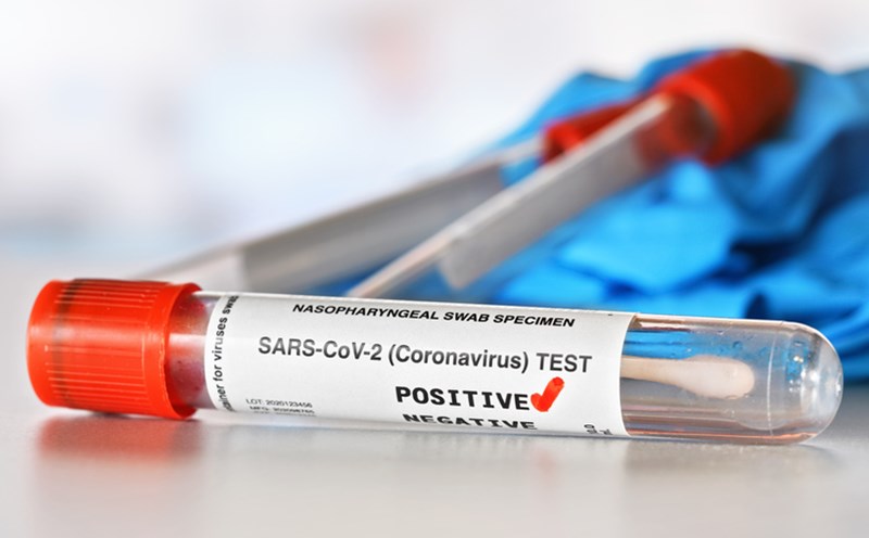 CORONAVIRUS TEST CONCEPT