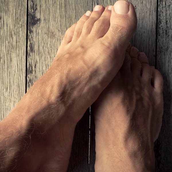 Ονυχομυκητίαση, αυτή η μάστιγα