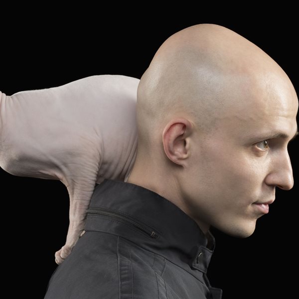 Βρέθηκε το φάρμακο κατά της φαλάκρας;