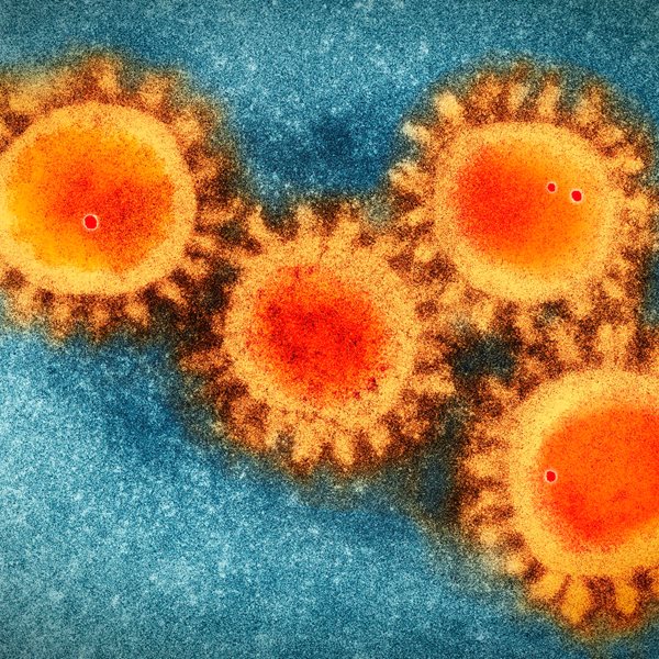 Κορονοϊός: Έξαρση ή δεύτερο κύμα στην Ευρώπη;