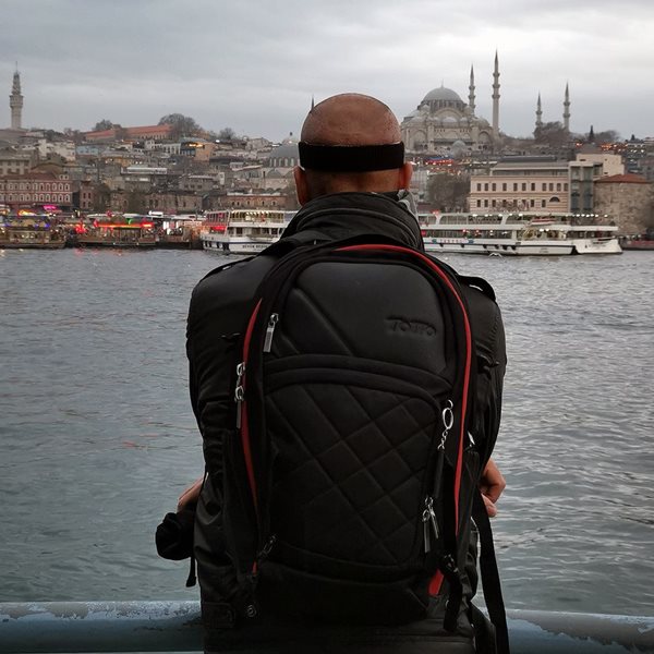 Μεταμόσχευση μαλλιών στην Τουρκία: Μια αληθινή μαρτυρία