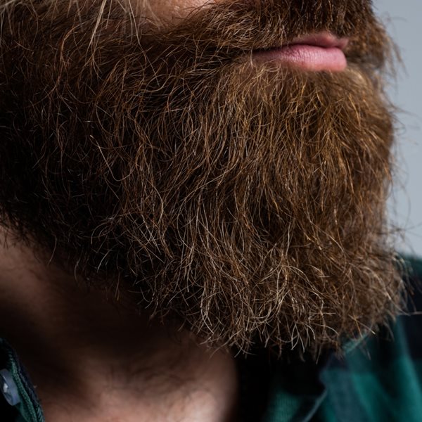 Ελεύθερος -κι ωραίος- από την πιτυρίδα στο μούσι