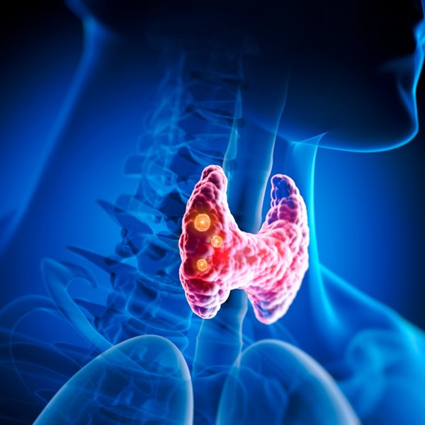 Αφαίρεση Θυρεοειδούς (Θυρεοειδεκτομή): Θα αλλάξει η ζωή μου μετά την επέμβαση; Τι πρέπει να περιμένω;