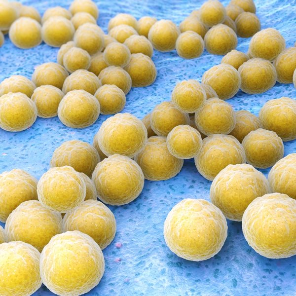 Τι είναι ο χρυσίζων σταφυλόκοκκος που οδήγησε στον θάνατο τον ψυχολόγο Δημήτρη Σκούρα