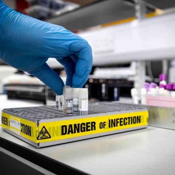 Μπορείς να νοσήσεις δύο φορές από κορονοϊό;