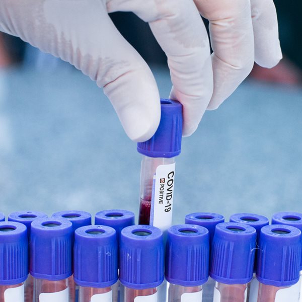 Το ποσοστό των πραγματικά ασυμπτωματικών με κορονοϊό σύμφωνα με νέα έρευνα