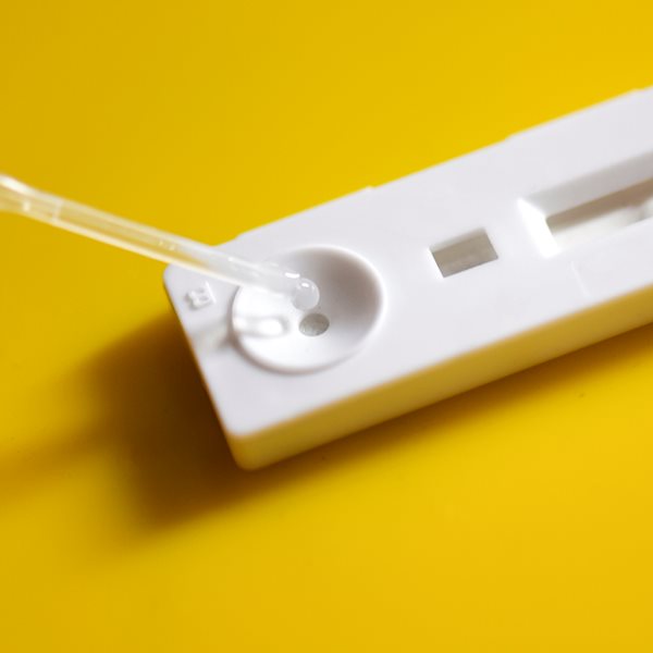 Νέο διαγνωστικό τεστ ανιχνεύει τον SARS-CoV-2 σε μόλις 5'