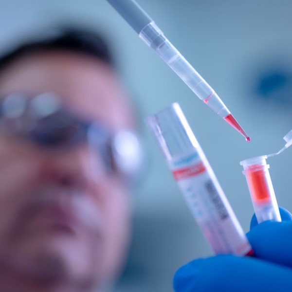 Γάλλος επιστήμονας ισχυρίζεται ότι θεράπευσε 1.003 ασθενείς με υδροξυχλωροκίνη