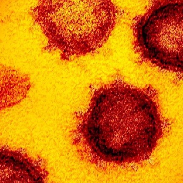 Πώς συμπεριφέρεται ο κορονοϊός στον οργανισμό, σύμφωνα με έναν ειδικό