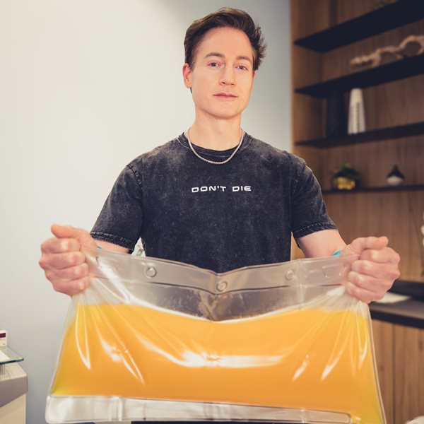 Mεγιστάνας αφαίρεσε 'όλο το πλάσμα από το σώμα του' για να δείχνει νεότερος