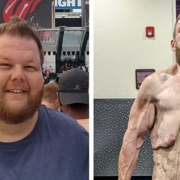 Ένας άντρας έχασε 152 κιλά και ιδού τα αποτελέσματα