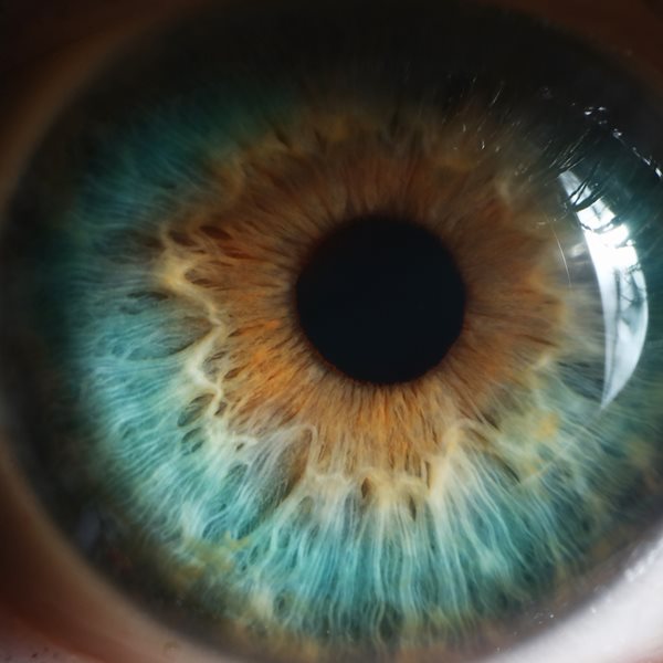 Αν έχεις αυτό το χρώμα ματιών, μάλλον είσαι πολύ 'τυχερός'