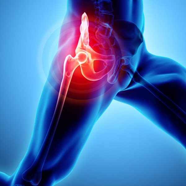 Ολική αρθροπλαστική ισχίου με την πλέον εξελιγμένη τεχνική