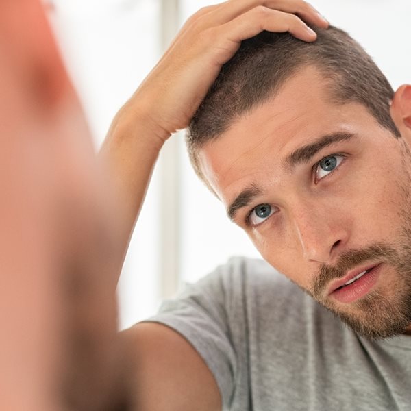 Τι είναι οι influencers τριχόπτωσης και γιατί πρέπει να τους ακολουθήσεις χθες