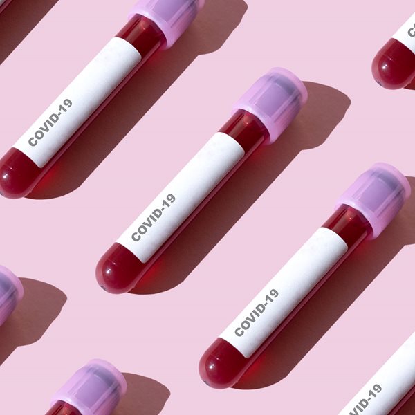 Πότε θα είναι έτοιμο ένα αποτελεσματικό εμβόλιο για τον κορονοϊό