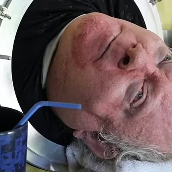 'Έφυγε' από τη ζωή ο Paul Alexander