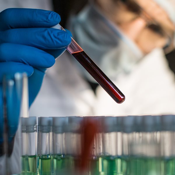 Η ομάδα αίματος που είναι η πιο ευάλωτη στον κορονοϊό