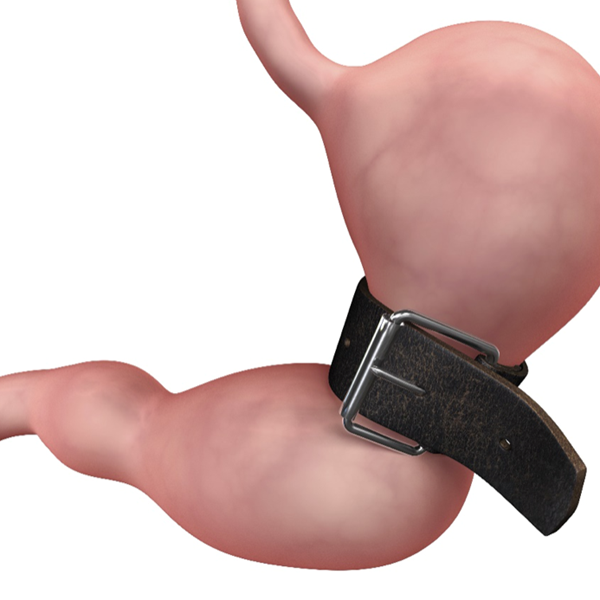 Ποια επέμβαση παχυσαρκίας σας ταιριάζει και για ποιους λόγους;