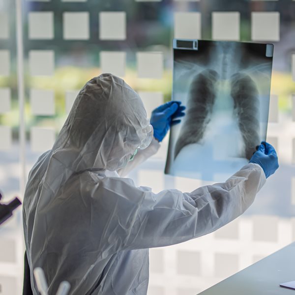 Ο SARS-COV-2 μπορεί να μεταδίδεται και με την αναπνοή σύμφωνα με νέα έρευνα