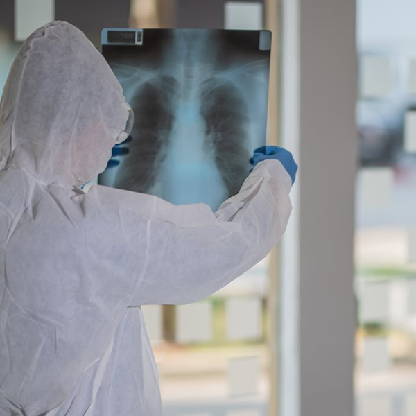 Τι είναι η "καταιγίδα κυτταροκινών" και πώς συνδέεται με τον κορονοϊό