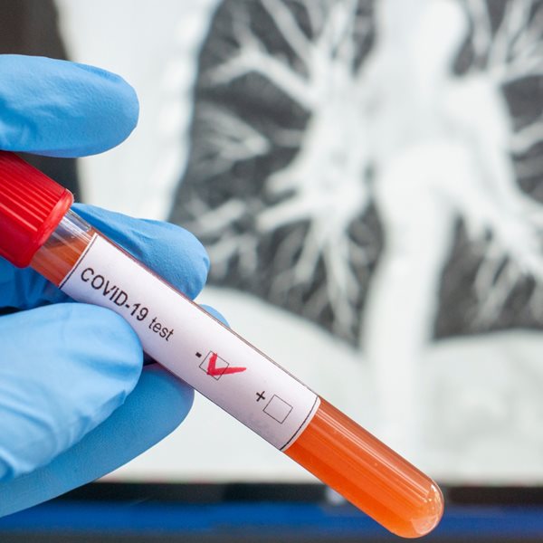 Ξεκίνησε η μετάγγιση πλάσματος από όσους ανέρρωσαν σε ασθενείς με κορονοϊό