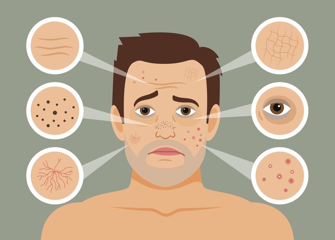 Η φροντίδα της επιδερμίδας σβήνει το στρες από το πρόσωπο