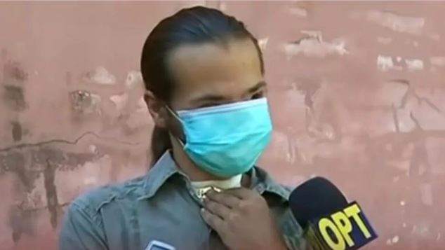 Κι όμως, το bullying σε ανθρώπους με παραμόρφωση στο πρόσωπο δε σταμάτησε ποτέ