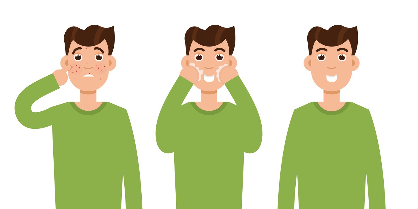 Η σωστή φροντίδα της λιπαρής επιδερμίδας