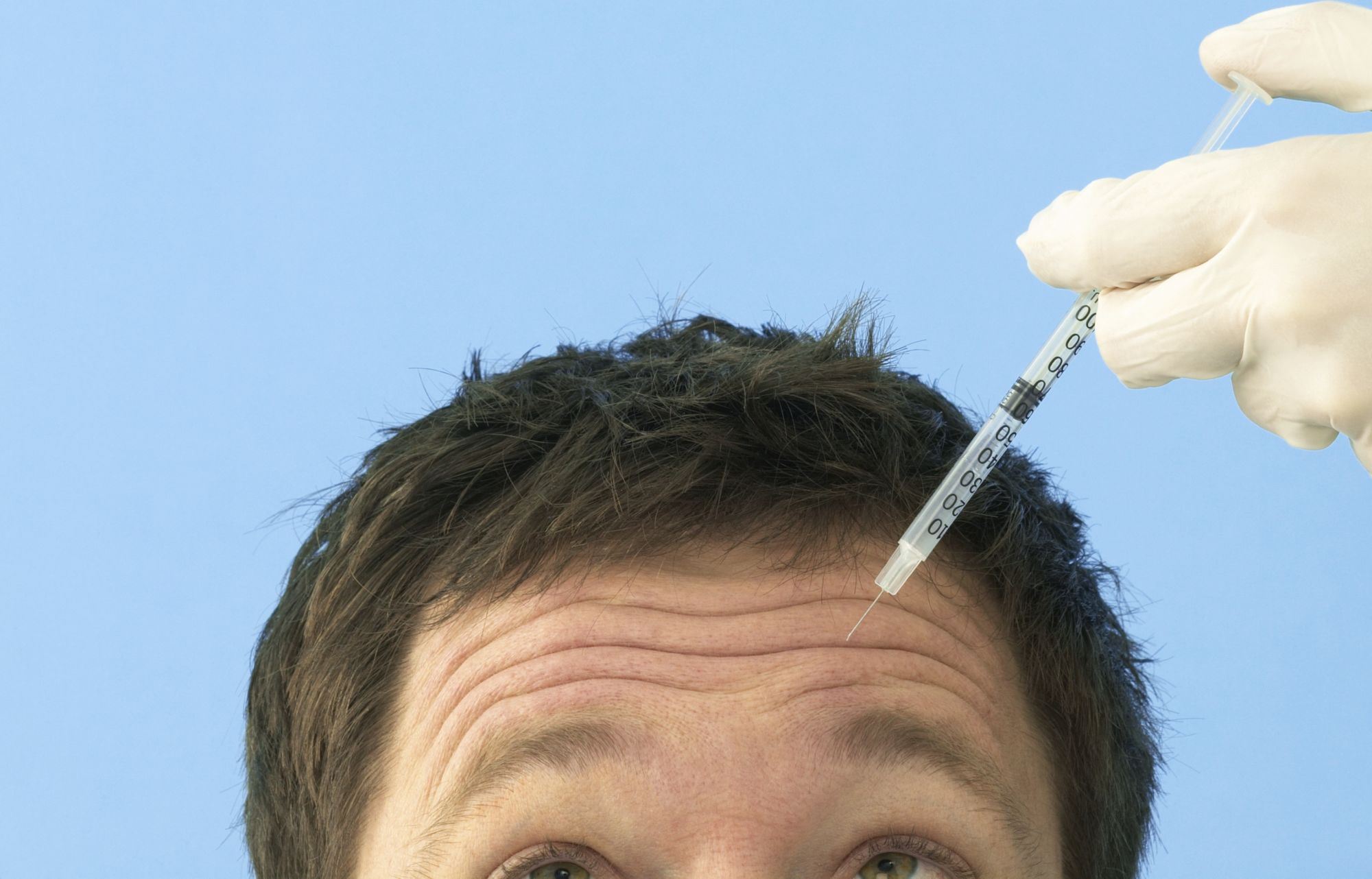 Κάνουν botox οι άντρες;