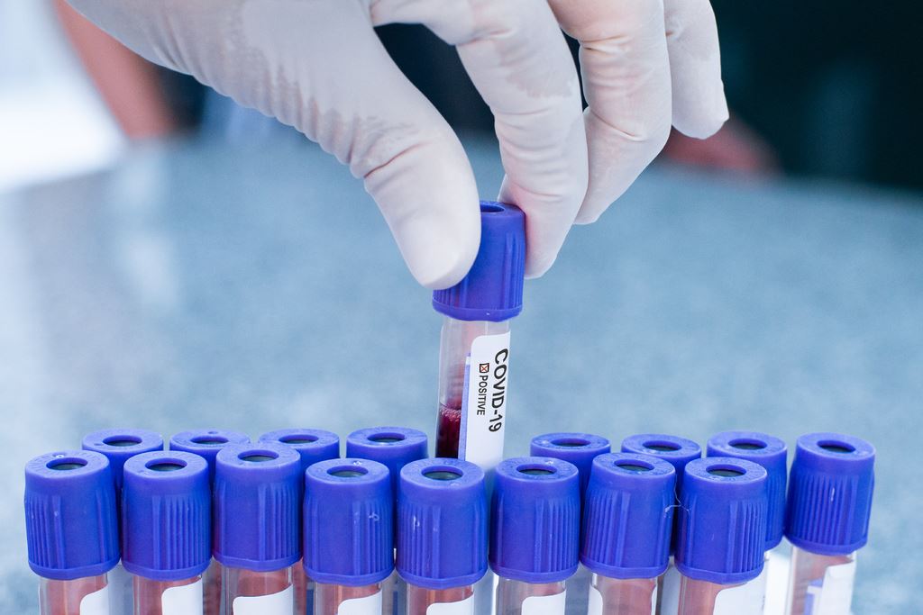 Το ποσοστό των πραγματικά ασυμπτωματικών με κορονοϊό σύμφωνα με νέα έρευνα