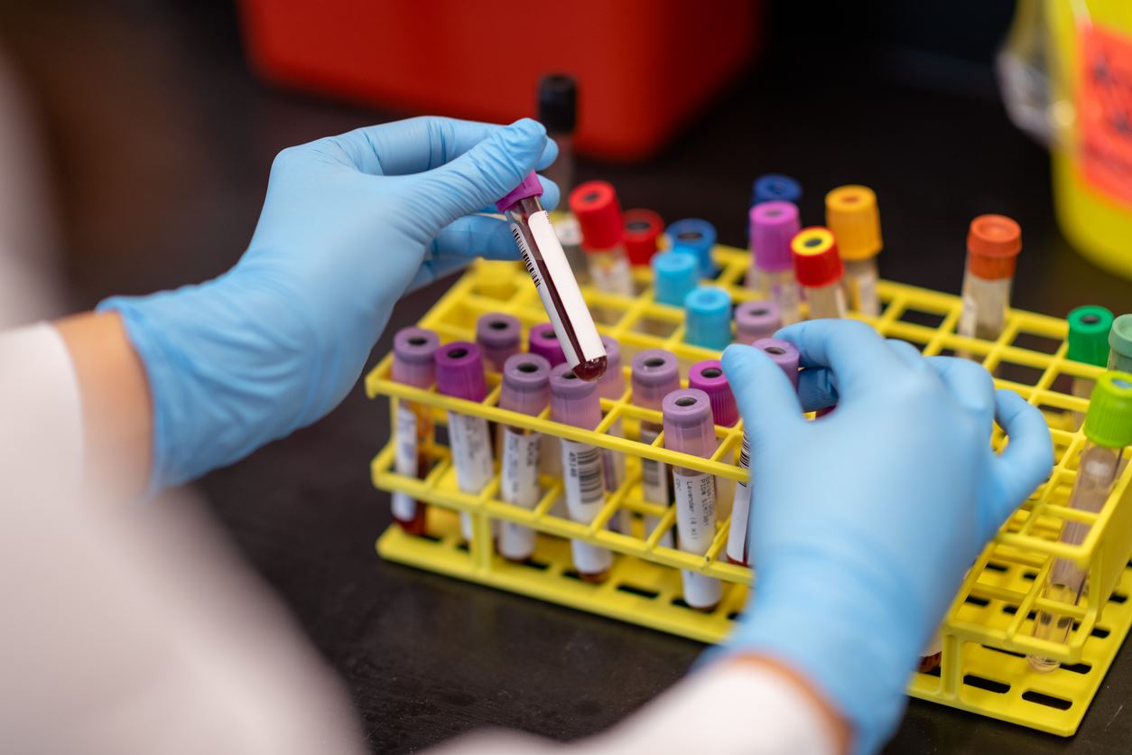 Τι είναι τα ορολογικά τεστ αντισωμάτων