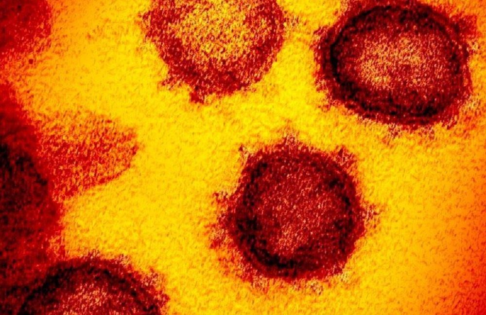 Πώς συμπεριφέρεται ο κορονοϊός στον οργανισμό, σύμφωνα με έναν ειδικό