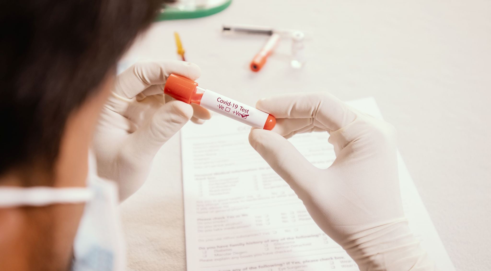 Το επιδημιολογικό προφίλ του κορονοϊού στην Ελλάδα