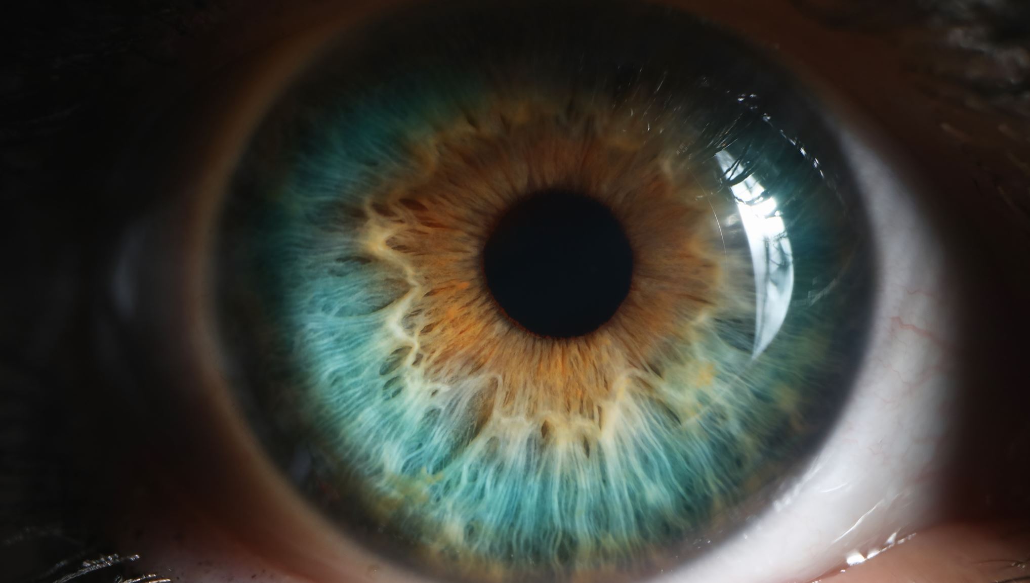 Αν έχεις αυτό το χρώμα ματιών, μάλλον είσαι πολύ 'τυχερός'