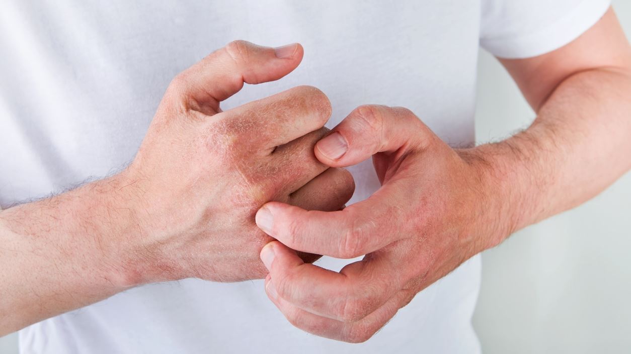 Είναι επικίνδυνο να κάνουμε κρακ στα δάχτυλά μας;