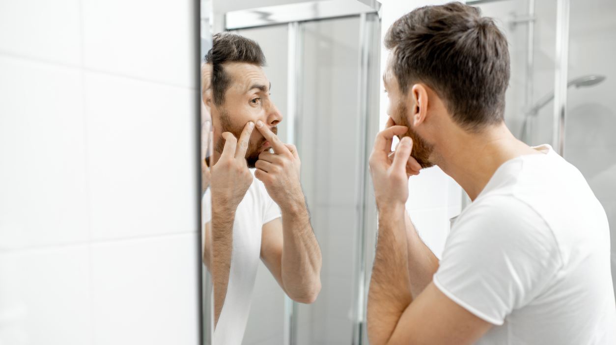 Ακμή ενηλίκων: Αιτίες εμφάνισης και τρόποι αντιμετώπισης