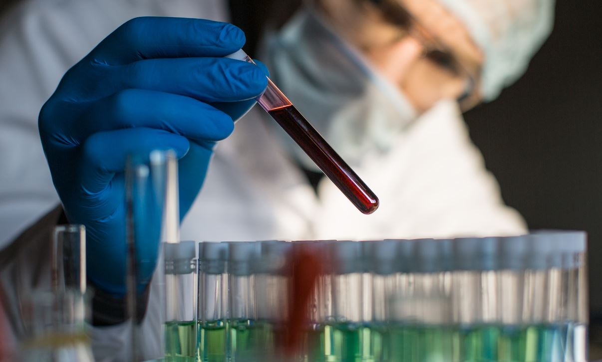 Η ομάδα αίματος που είναι η πιο ευάλωτη στον κορονοϊό